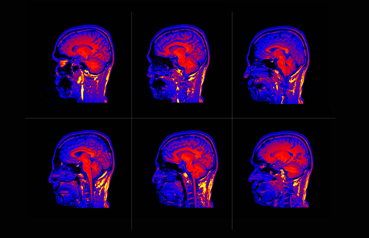 Repeating image of a brain MRI